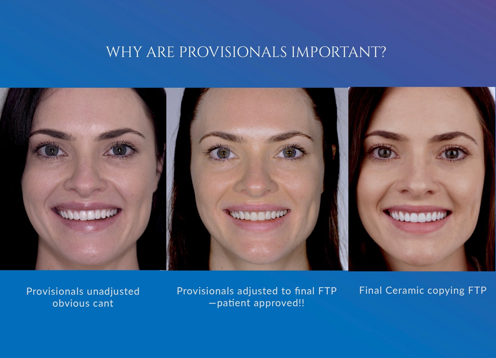 Why provisionals are important