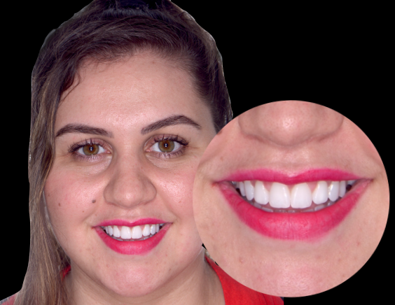 Lock confidence example