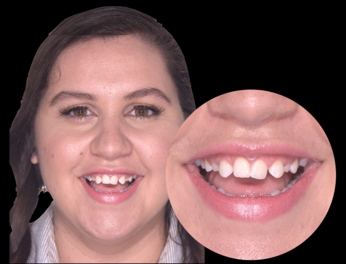 Pre-treatment data example