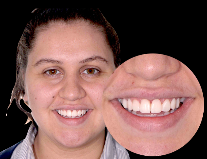 Trial design example